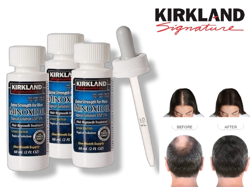 Minoxidil za rast kose i brade